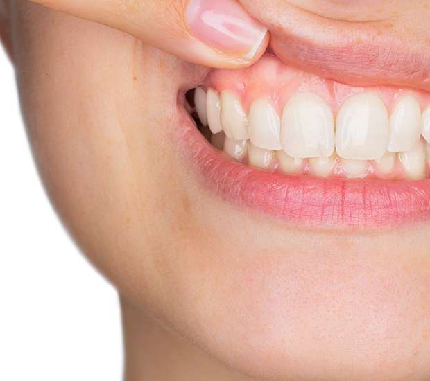 Hialeah Gum Disease